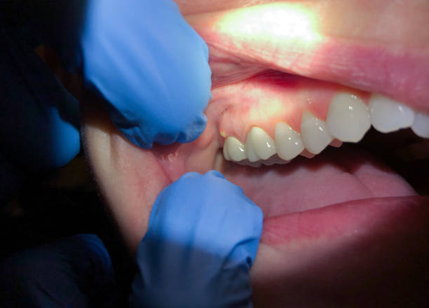 Best Walk-In Emergency Dentist in Lexington Park, MD
